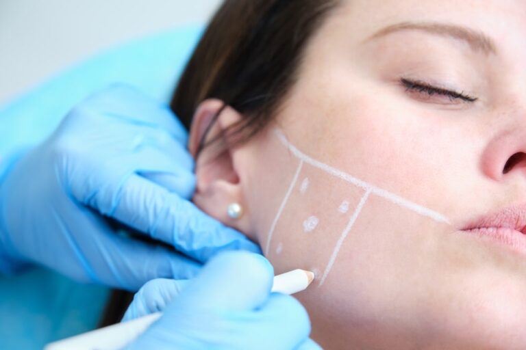bruxism-teeth-grinding