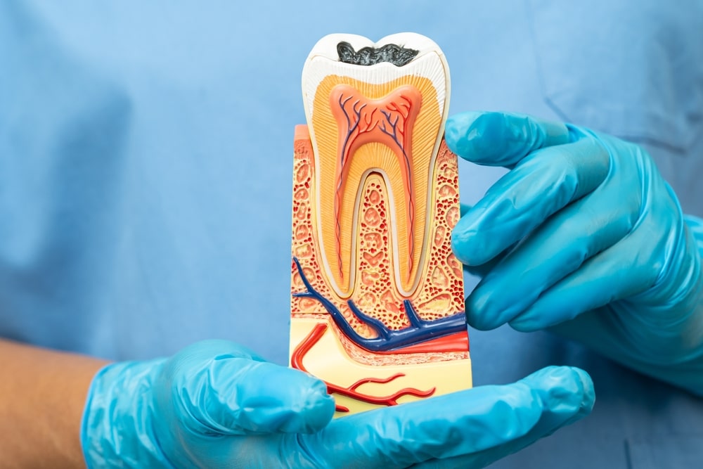 gum-disease