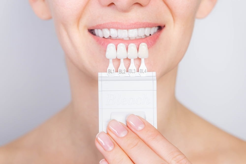 porcelain-veneers-suitability