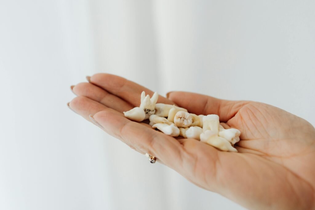tooth-extraction-toronto